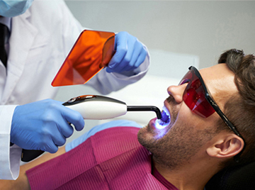 Which is the Safest Dental Filling Material?