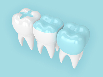 How to Choose the Right Filling Material for You