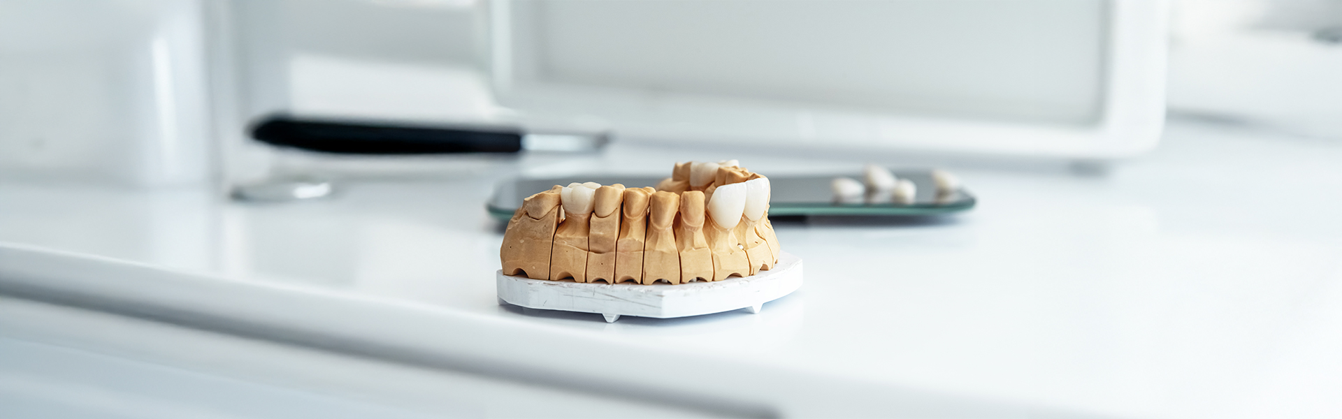 Why Porcelain Veneers Are the Best Solution for Discolored, Chipped, or Misaligned Teeth