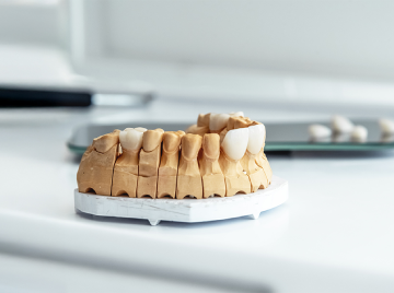 Why Porcelain Veneers Are the Best Solution for Discolored, Chipped, or Misaligned Teeth