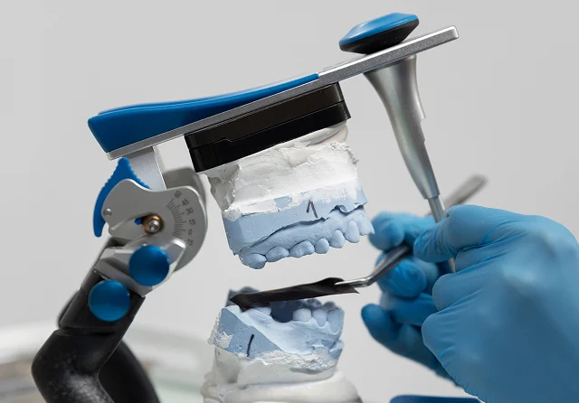 Dental Bridges