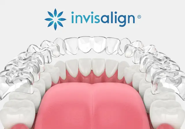 Invisalign