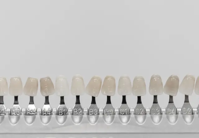 Veneers