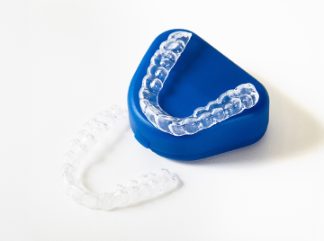 How Clear Aligners Straighten Your Teeth Step by Step