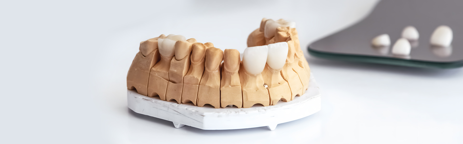 7 Signs You May Be a Good Candidate for Dental Veneers