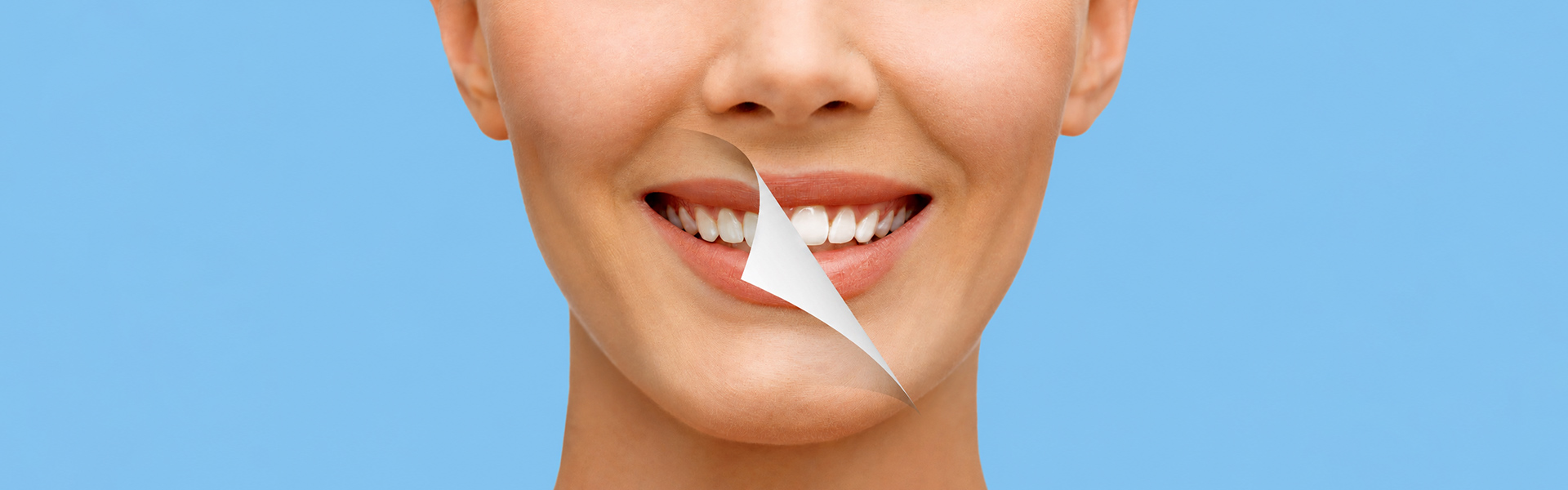 How Zoom Teeth Whitening Can Brighten Your Smile in Just One Visit